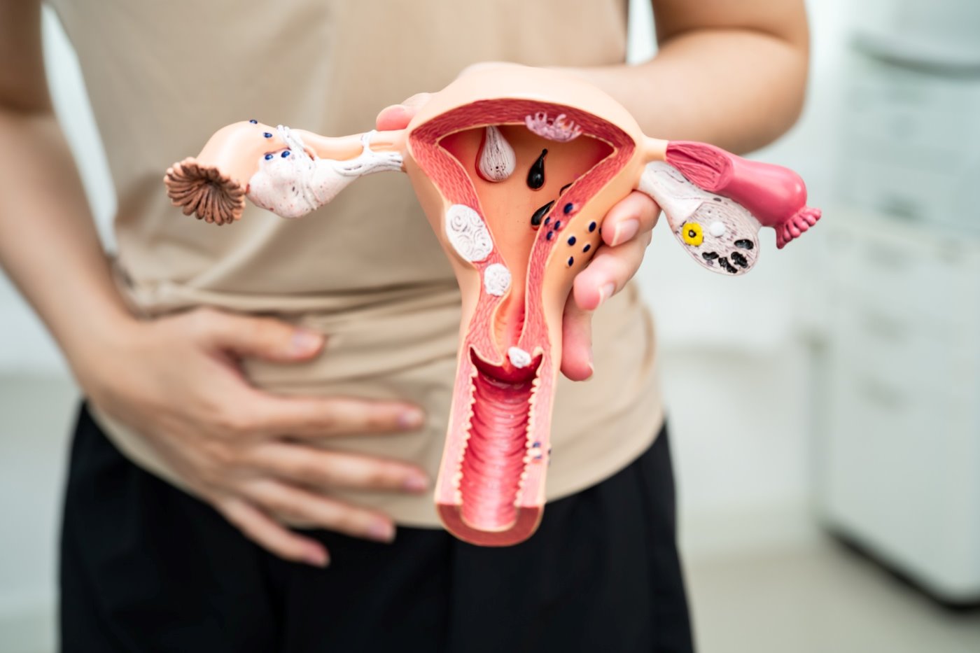 Woman holding an anatomical model of the uterus and ovaries